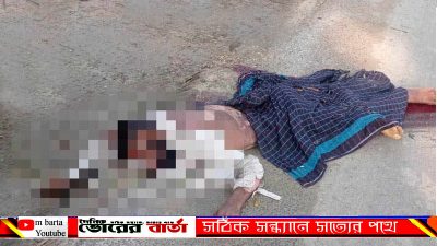 আহতরা হলেন উপজেলার বাগাট