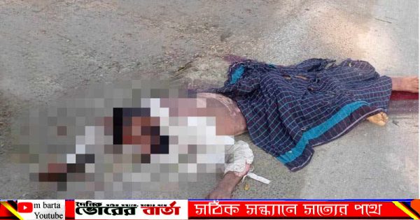আহতরা হলেন উপজেলার বাগাট