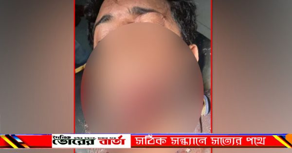 গুরুতর আহত করার অভিযোগ