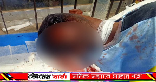 তাই আমি দলের নেতৃত্ব দেই,আমার