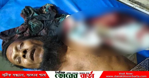 এ ঘটনায় উক্ত এলাকায় অতিরিক্ত পুলিশ