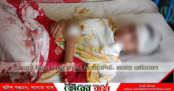 পিতা কর্তৃক মেয়ে কে মারপিট
