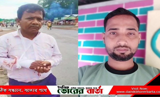 আহত হওয়া সাংবাদিক কে সহায়তা করলেন