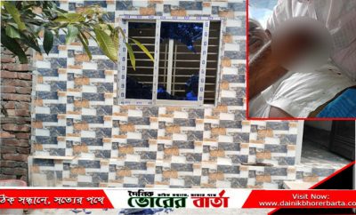 গুরুতর আহত ৬৫ বছরের বৃদ্ধ