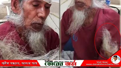 বৃদ্ধকে মেরে আহত টেনে ছিঁড়ে ফেলেছে দাড়ি