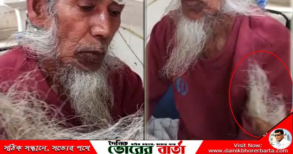 বৃদ্ধকে মেরে আহত টেনে ছিঁড়ে ফেলেছে দাড়ি