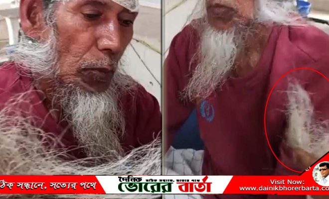 বৃদ্ধকে মেরে আহত টেনে ছিঁড়ে ফেলেছে দাড়ি