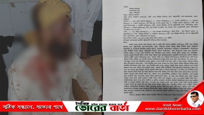আলফাডাঙ্গায় জমিয়তে উলামায়ে ইসলাম নেতাকে কুপিয়ে জখম