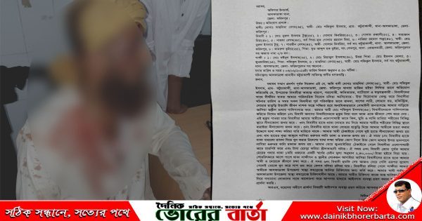 আলফাডাঙ্গায় জমিয়তে উলামায়ে ইসলাম নেতাকে কুপিয়ে জখম