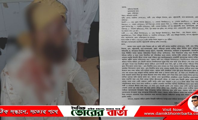 আলফাডাঙ্গায় জমিয়তে উলামায়ে ইসলাম নেতাকে কুপিয়ে জখম